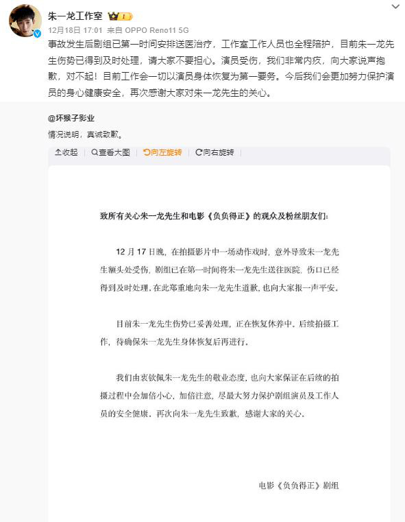 朱一龙在《负负得正》拍摄中额头意外受伤，其工作室已确认平安